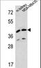 L-2-Hydroxyglutarate Dehydrogenase antibody, LS-C165661, Lifespan Biosciences, Western Blot image 
