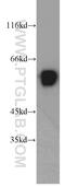 UPF3B Regulator Of Nonsense Mediated MRNA Decay antibody, 23301-1-AP, Proteintech Group, Western Blot image 