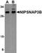 Nipsnap Homolog 3B antibody, orb75116, Biorbyt, Western Blot image 
