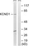 Potassium Voltage-Gated Channel Subfamily D Member 1 antibody, PA5-39350, Invitrogen Antibodies, Western Blot image 