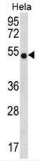 Chitinase 3 Like 2 antibody, AP50894PU-N, Origene, Western Blot image 