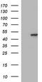 Tubulin Beta 2B Class IIb antibody, CF506601, Origene, Western Blot image 