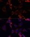 Insulin Like Growth Factor 2 Receptor antibody, LS-C748085, Lifespan Biosciences, Immunofluorescence image 