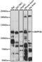Inositol Polyphosphate-5-Phosphatase B antibody, 19-218, ProSci, Western Blot image 