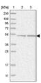 Asparaginyl-TRNA Synthetase 2, Mitochondrial antibody, PA5-55420, Invitrogen Antibodies, Western Blot image 