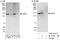 Zinc Finger ZZ-Type Containing 3 antibody, A303-331A, Bethyl Labs, Immunoprecipitation image 