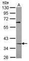 Kruppel Like Factor 3 antibody, NBP2-15008, Novus Biologicals, Western Blot image 