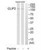 CAP-Gly Domain Containing Linker Protein 2 antibody, TA314671, Origene, Western Blot image 