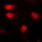 Calcium/calmodulin-dependent protein kinase kinase 1 antibody, orb47987, Biorbyt, Immunofluorescence image 