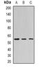 Bactericidal Permeability Increasing Protein antibody, orb340894, Biorbyt, Western Blot image 