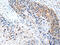 Cripto, FRL-1, Cryptic Family 1 antibody, CSB-PA120126, Cusabio, Immunohistochemistry paraffin image 