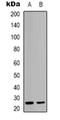High mobility group protein B2 antibody, orb318774, Biorbyt, Western Blot image 