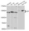 Ceruloplasmin antibody, orb373675, Biorbyt, Western Blot image 