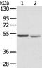 Solute Carrier Family 8 Member B1 antibody, PA5-50827, Invitrogen Antibodies, Western Blot image 