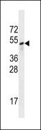 Sestrin 3 antibody, LS-C203698, Lifespan Biosciences, Western Blot image 