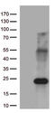 Myosin Light Chain 9 antibody, M06446, Boster Biological Technology, Western Blot image 