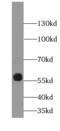 Kynurenine 3-Monooxygenase antibody, FNab04668, FineTest, Western Blot image 