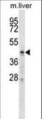 Zinc Finger DHHC-Type Containing 6 antibody, LS-C160764, Lifespan Biosciences, Western Blot image 