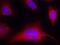 Protein Kinase D1 antibody, PA5-37694, Invitrogen Antibodies, Immunofluorescence image 