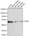 Elongation factor Tu, mitochondrial antibody, 22-209, ProSci, Immunofluorescence image 
