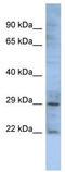 Gap Junction Protein Beta 1 antibody, TA341660, Origene, Western Blot image 