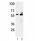 Glucose-6-phosphate 1-dehydrogenase antibody, F49019-0.4ML, NSJ Bioreagents, Western Blot image 
