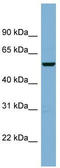 CCR4-NOT Transcription Complex Subunit 11 antibody, TA344993, Origene, Western Blot image 