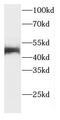 Cystinosin, Lysosomal Cystine Transporter antibody, FNab02059, FineTest, Western Blot image 