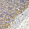 Fascin Actin-Bundling Protein 1 antibody, LS-B14873, Lifespan Biosciences, Immunohistochemistry frozen image 