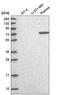 DNA replication licensing factor MCM8 antibody, HPA045141, Atlas Antibodies, Western Blot image 