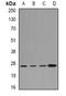 Chloride Intracellular Channel 1 antibody, orb341050, Biorbyt, Western Blot image 