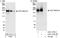 Bromodomain Adjacent To Zinc Finger Domain 1A antibody, A301-318A, Bethyl Labs, Immunoprecipitation image 