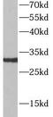 Killer Cell Lectin Like Receptor C1 antibody, FNab05744, FineTest, Western Blot image 