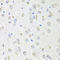 Cathepsin K antibody, LS-C331688, Lifespan Biosciences, Immunohistochemistry frozen image 