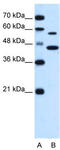 Zinc transporter ZIP5 antibody, TA334617, Origene, Western Blot image 
