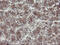 Diphthamide Biosynthesis 2 antibody, M12485, Boster Biological Technology, Immunohistochemistry paraffin image 