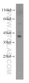 Alanine--Glyoxylate And Serine--Pyruvate Aminotransferase antibody, 22394-1-AP, Proteintech Group, Western Blot image 