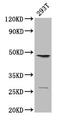 Vascular Endothelial Growth Factor C antibody, CSB-PA07545A0Rb, Cusabio, Western Blot image 