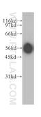 Activin A Receptor Type 1C antibody, 12610-1-AP, Proteintech Group, Western Blot image 