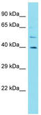 Olfactory Receptor Family 10 Subfamily J Member 3 antibody, TA336179, Origene, Western Blot image 