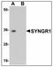 Synaptogyrin-1 antibody, AP23934PU-N, Origene, Western Blot image 
