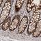 Mitochondrial Ribosomal Protein L41 antibody, HPA027160, Atlas Antibodies, Immunohistochemistry paraffin image 
