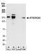 Sca2 antibody, A301-118A, Bethyl Labs, Western Blot image 
