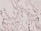 p130cas antibody, A00960, Boster Biological Technology, Immunohistochemistry paraffin image 