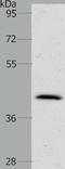 NK2 Homeobox 1 antibody, TA323321, Origene, Western Blot image 