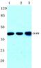 Carbonate dehydratase VB antibody, PA5-75391, Invitrogen Antibodies, Western Blot image 