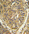 Fibroblast growth factor receptor 2 antibody, LS-C97522, Lifespan Biosciences, Immunohistochemistry paraffin image 