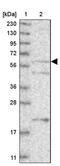 E3 ubiquitin-protein ligase RNF220 antibody, PA5-55660, Invitrogen Antibodies, Western Blot image 