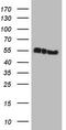 Keratin 16 antibody, TA808255, Origene, Western Blot image 