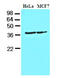 CKI-alpha antibody, AM09078PU-S, Origene, Western Blot image 